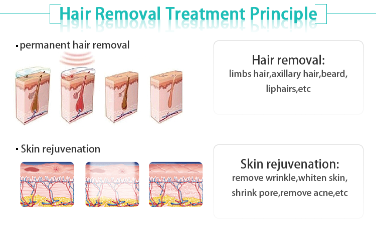 2018 high quality clinic use professional multifunction e-light ipl SHR hair removal technology:The newest generation of Intense Pulsed Light (IPL) systems, produces a precise beam of light energy, which safely transmits through the skin, selectively targeting pigment in hair the follicles. When this light is absorbed by the pigment in the follicle of the hair, it coverts to heat, which in turn causes thermal damage to the follicle and permanently destroys the hair. The heat also disables the cells responsible for new hair growth. The newest generation of Intense Pulsed Light (IPL) systems, produces a precise beam of light energy, which safely transmits through the skin, selectively targeting pigment in hair the follicles. When this light is absorbed by the pigment in the follicle of the hair, it coverts to heat, which in turn causes thermal damage to the follicle and permanently destroys the hair. The heat also disables the cells responsible for new hair growth. :The newest generation of Intense Pulsed Light (IPL) systems, produces a precise beam of light energy, which safely transmits through the skin, selectively targeting pigment in hair the follicles. When this light is absorbed by the pigment in the follicle of the hair, it coverts to heat, which in turn causes thermal damage to the follicle and permanently destroys the hair. The heat also disables the cells responsible for new hair growth. 