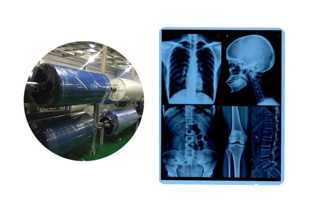 Printing Radiology Universal Medical Thermal Hospital Blue X-ray Film