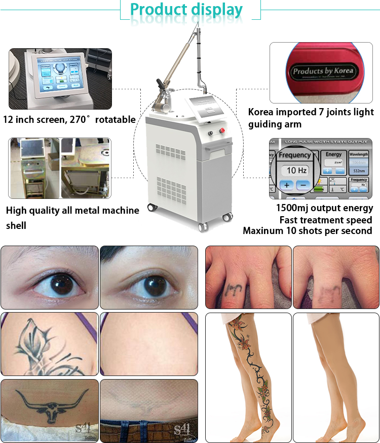 Professional all color tattoo machine q switched nd yag laser freckle removal permanent