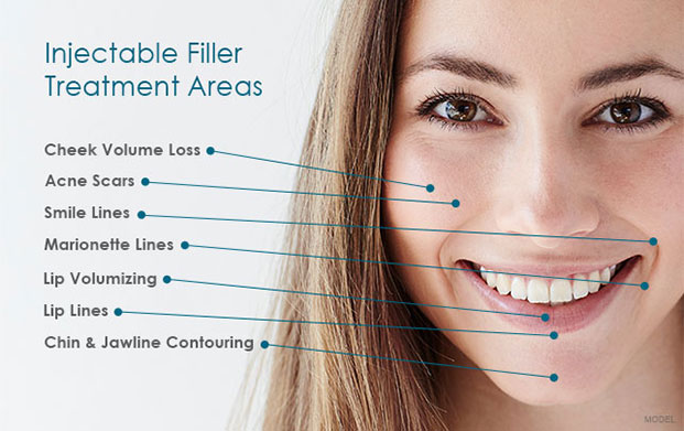 What are dermal fillers? Dermal fillers help to diminish facial lines and restore volume and fullness in the face. As we age, our faces naturally lose subcutaneous fat. The facial muscles are