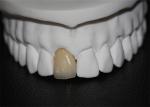 Co Cr Porcelain Dental Crown