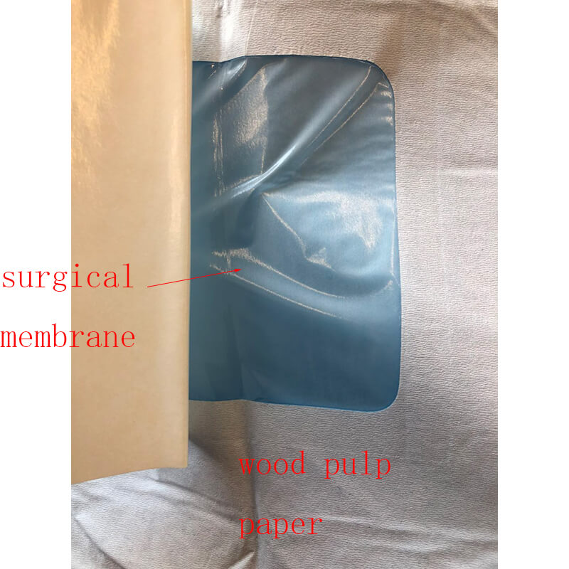 surgical angiography drape for angiography procedure