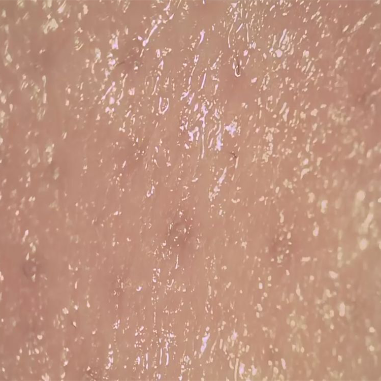 Skin Moisture Detector Wireless Digital Skin Analyzer To Observe Surface Of Skin Derm Pores