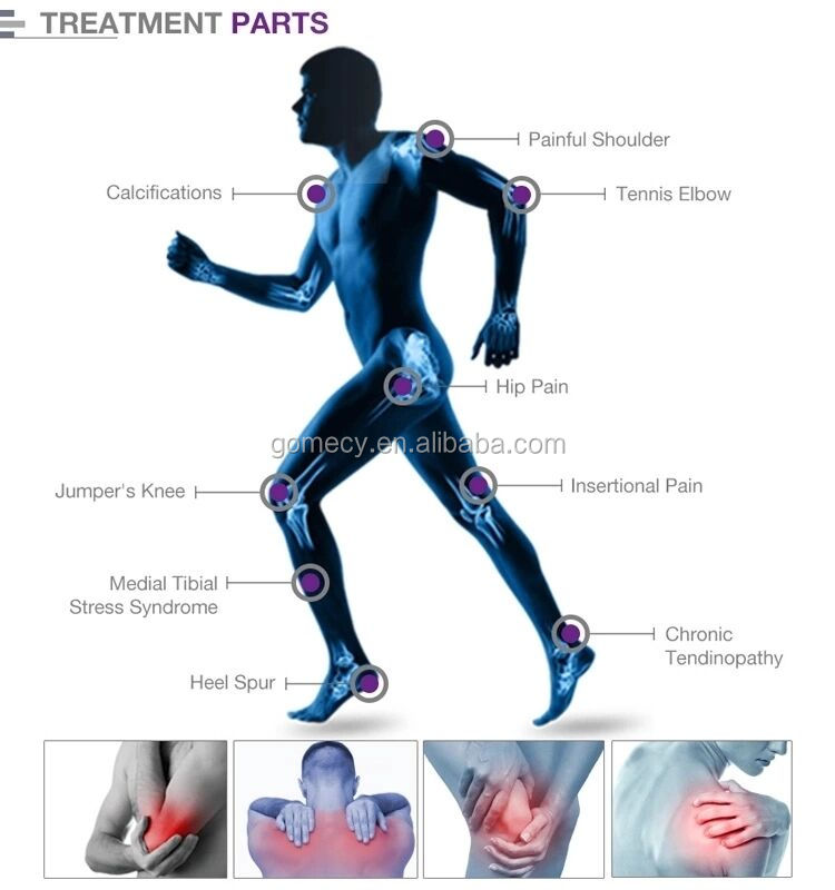 ems shockwave therapy pain relieve.jpg.jpg