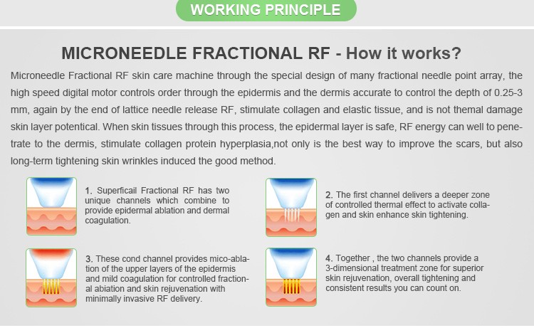 2017 Newest fractional rf/fractional rf microneedling/fractional rf micro needle machine