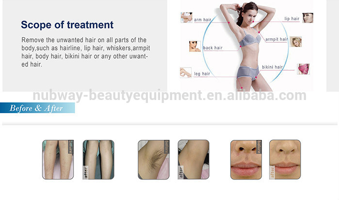 2015 NUbway Newest professional 808nm diode laser /diode laser hair removal/ diode laser 808 beauty device