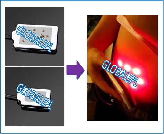 desktop diode laser fat lipolysis machine