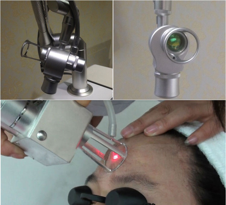 10600nm acne scar removal skin rejuvenation Fractional co2 laser machine 
