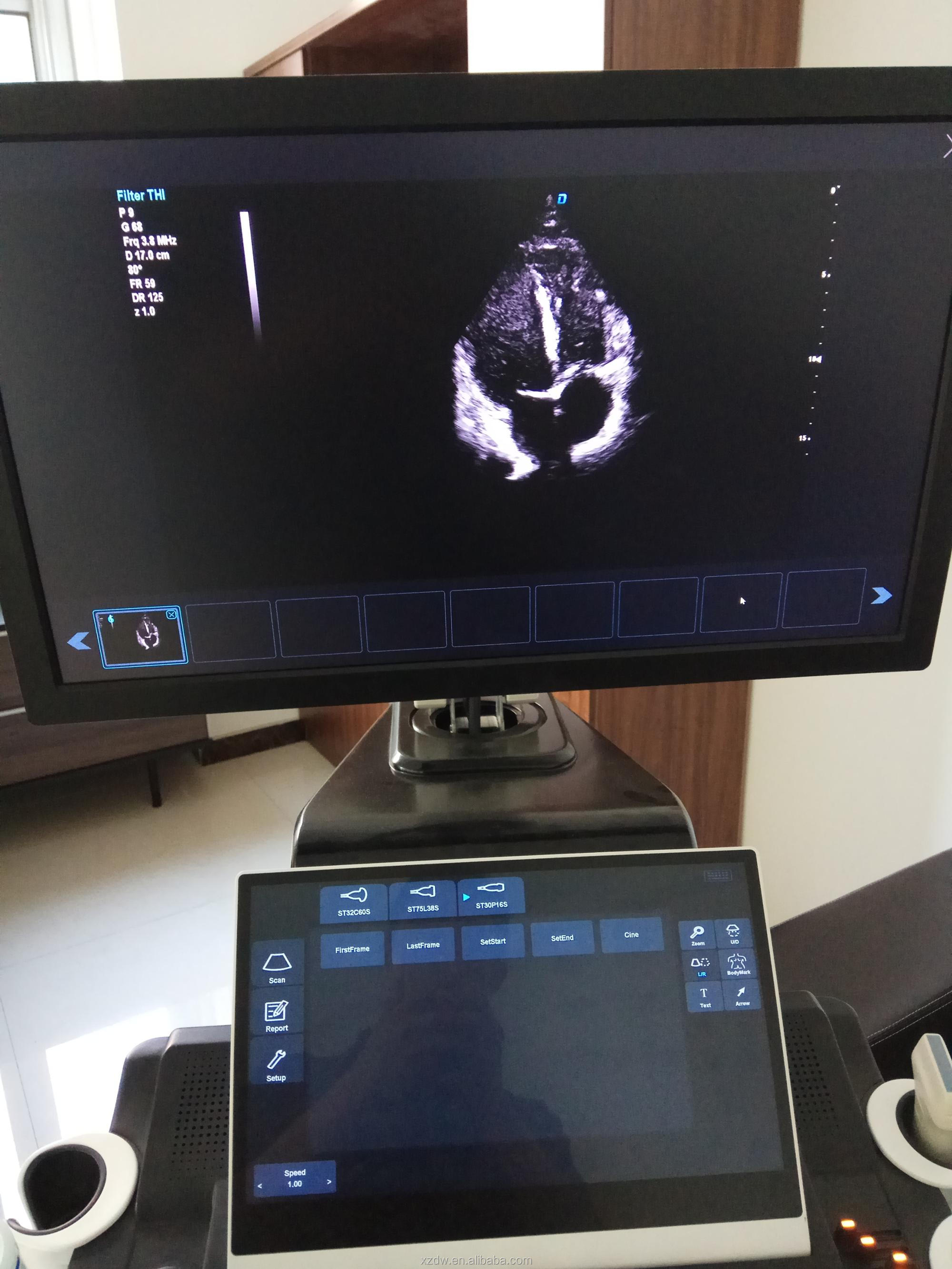 New arrival DW-T8 Elastography trolley ultrasonic scanner 4D cardiac color doppler ultrasound with TDI