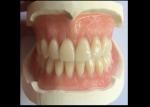 CAD CAM Rubber 3D Printed Tooth Crown Easy Maintain Great Fit