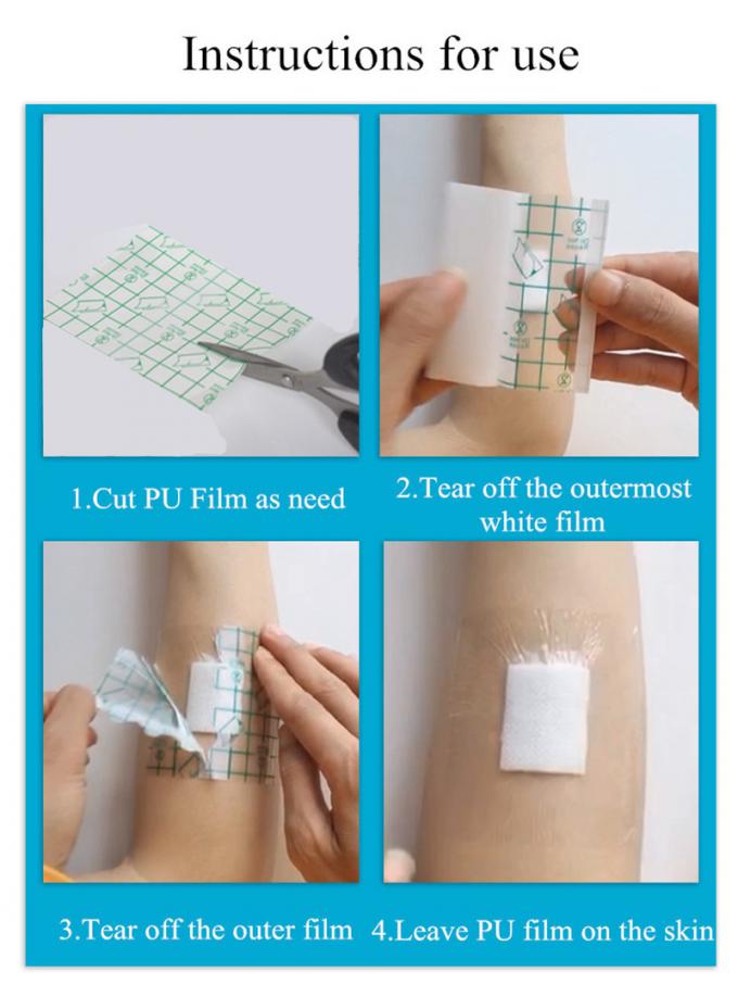 Sterile Waterproof Wound Soft PU Film Adhesive Dressing Soft And Comfortable 1