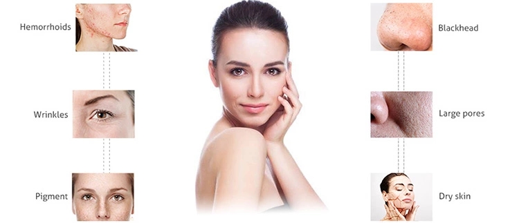 GOMECY skin analyzerskin care machine beauty equipment for facial skin analysis
