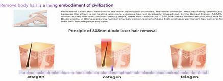 808nm Diode Laser Hair Removal Machine For Underarm , Armpit Hair Removal