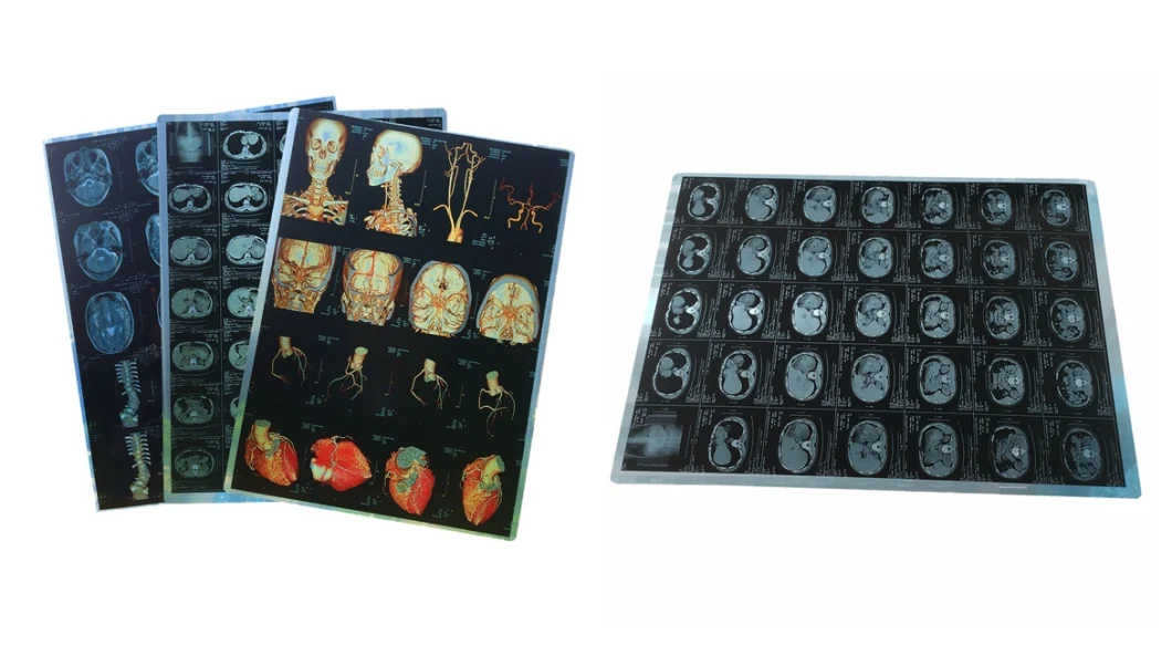 Dry Medical X-ray Thermal Film CT Scan 14X17inch X Ray Film Cheap Price Medical Film