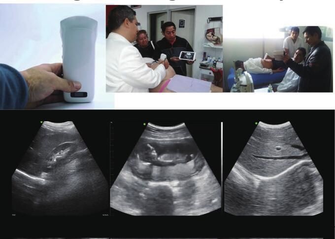 Handheld Black And White Ultrasound Machine Portable Wireless Ultrasound Machine With Convex And Linear 128 Elements 2
