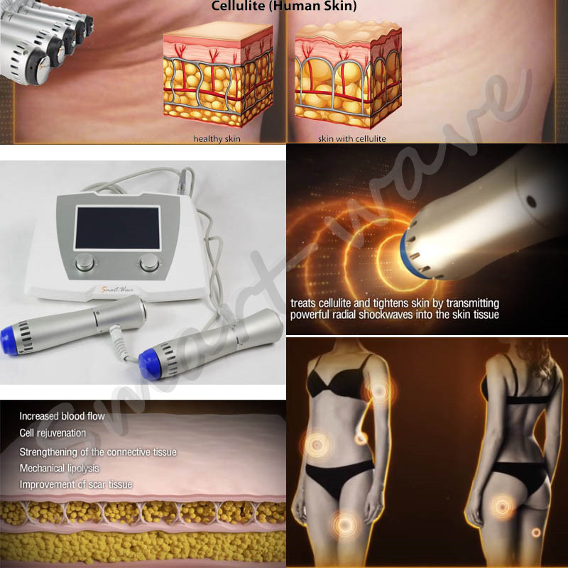 Powerful acoustic shock wave cellulite reduce therapy equipment with ultrasonic cavitation CE
