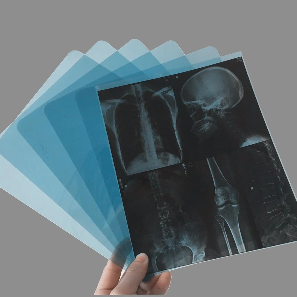 Compatible with Agfa Printer Hospital CT Cr Using Thermal Medical X-ray Film