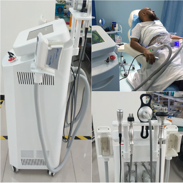 2018 hottest CE approved cryolipolysis fat freezing weight loss clinic beauty machine with cavitaion, RF, cool sculpting