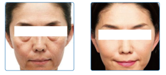 Facial Treatment PDT LED Light Therapy Machine , Photon LED Skin Rejuvenation Machine 0