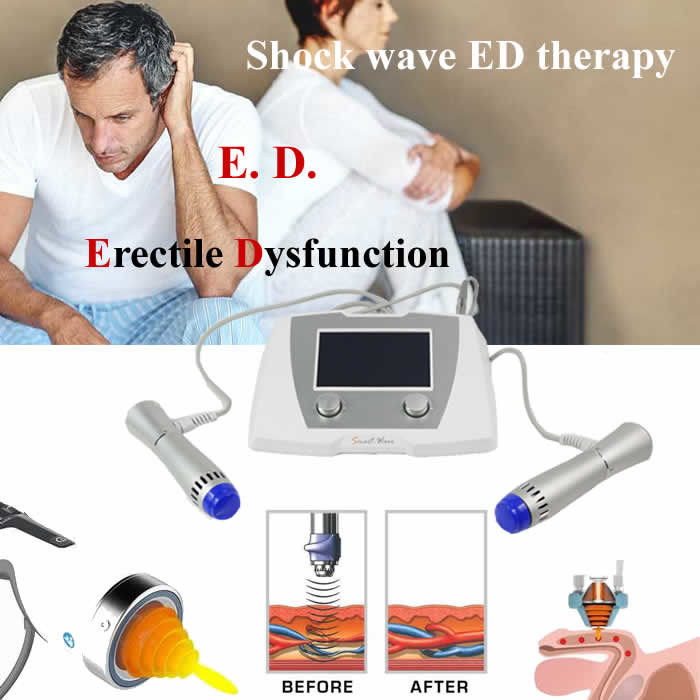 Li-eswt ED mini portable tabletop shock wave machine ed 1000 shock wave therapy buy apparatus for shock-wave therapy