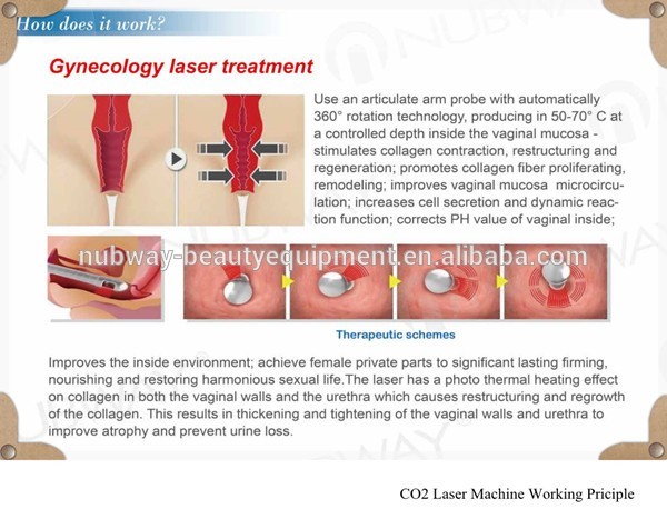How Co2 Laser Vaginal Tightening work.jpg