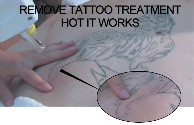 luxury laser tattoo removal machine with 1064nm, 532nm, 755nm, 1320nm and fractional 5 tips