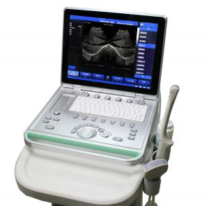 China SS-8 Laptop Ultrasound B scanner(ARM based) home ultrasound machines handheld ultrasound wholesale