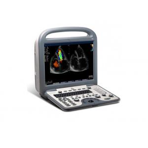 Cardiac Stress Portable Ultrasound Scanner Color Doppler Hand Held Ultrasound Devices
