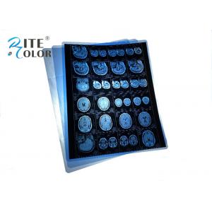 Waterproof PET Blue Medical X Ray Film For MRI CT CR Dental Panorama Images Output