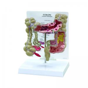 China Medical Teaching Pathology Colon Human Anatomy Model 22.5cm On Science supplier