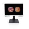 China 15-inch Monitor Mode Selection TUYOU All-in-One Medical Endoscope Camera with Light Source for Urology and Gynecology wholesale