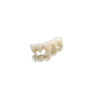 China Fit Properly Crown And Bridge Teeth Cobalt Chromium Full Metal Crown on sale