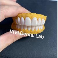China Dental Snap On Smile Veneers High esthetics ISO FDA Certified on sale