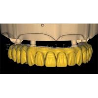 China OEM Dental Crown Design Uses Advanced Scanning And 3D Printing Technology on sale
