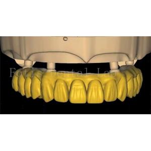 OEM Dental Crown Design Uses Advanced Scanning And 3D Printing Technology