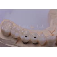 China Titanium / Zirconia Dental Crown Silver Polished For Missing Teeth on sale