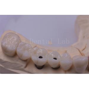 Titanium / Zirconia Dental Crown Silver Polished For Missing Teeth