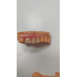 Durable TCS Flexible Partial Valplast Flexible Dentures Stain Resistant