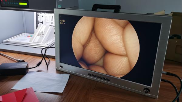 Full HD 1080P 4 In 1 One Integrated Portable Medical Endoscope Camera System