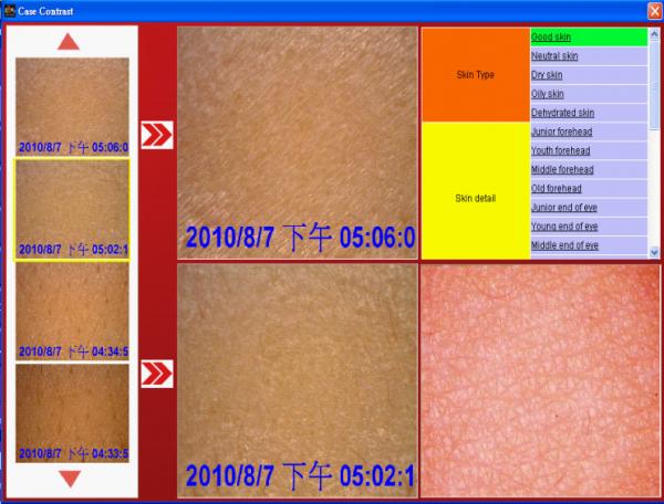 Одобренная КЭ многофункциональная машина анализатора кожи для сенситивенесс кожи