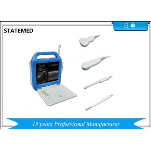 China Hospital Laptop Ultrasound Scanner , 240 MM Scanning Depth Portable Ultrasound Equipment supplier