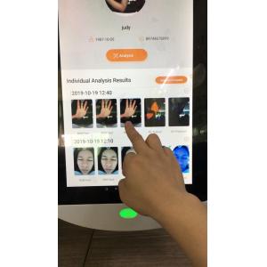 Korea Facial Analysis System Digital 64gb Storage For Doctor Clinic