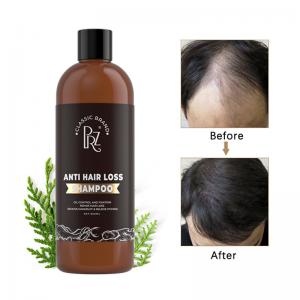 Argan Oil Anti Dandruff Anti Hair Loss Shampoo And Conditioner Customized Private Label