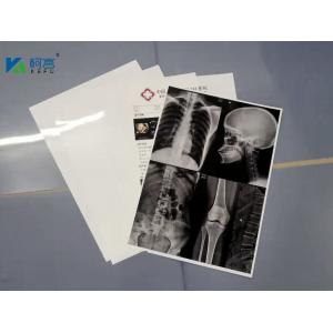 13X17'' White 180 Microns PET X Ray Film Sheets Transparency Film For Inkjet Printers