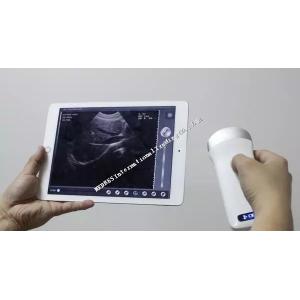 Ipad connecting Wireless Convex Probe Ultrasound Scanner with built-in battery