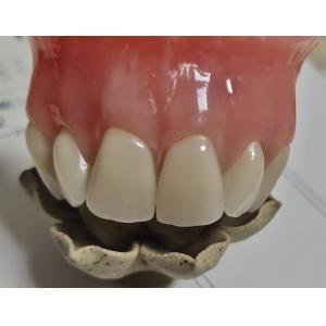 Esthetics Full Denture Cold Cured Acrylic Partial Denture