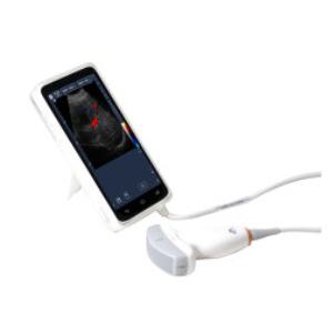 High Resolution Portable Doppler Ultrasound Machine With 6 Inch Full Touch Screen