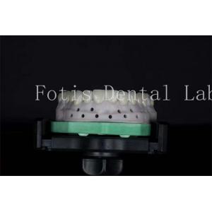 High Strength Dental Lab Veneers Customizable For Natural Smiles