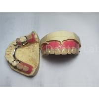 China Comfortable Peek Partial Denture / Removable Dental Prosthesis Customized on sale