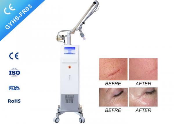 3 In 1 System CO2 Laser Beauty Equipment For For Acne Scars Removal Safe